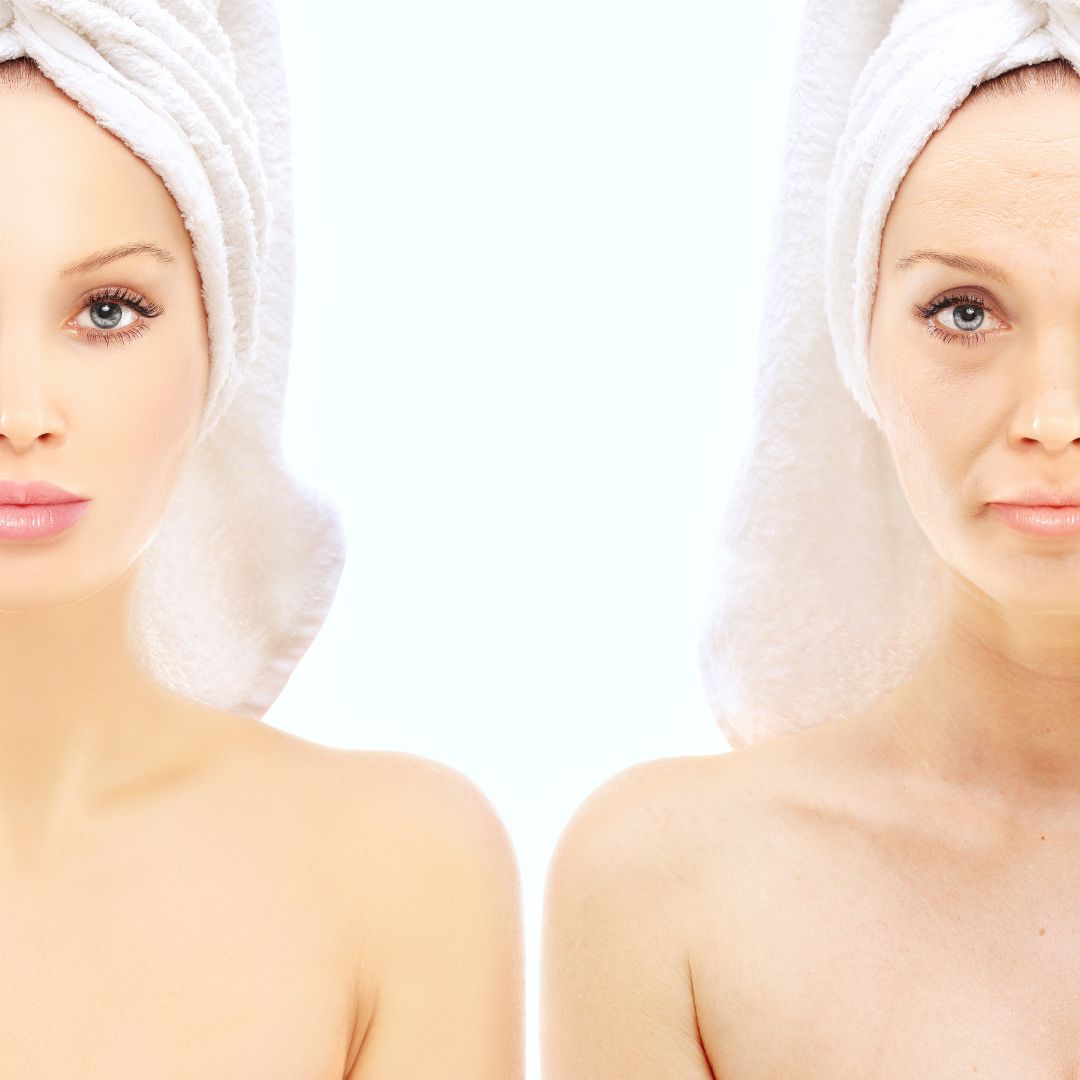 facial-liposuction